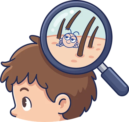 Illustrazione di un bambino che osserva il proprio cuoio capelluto con una lente di ingrandimento